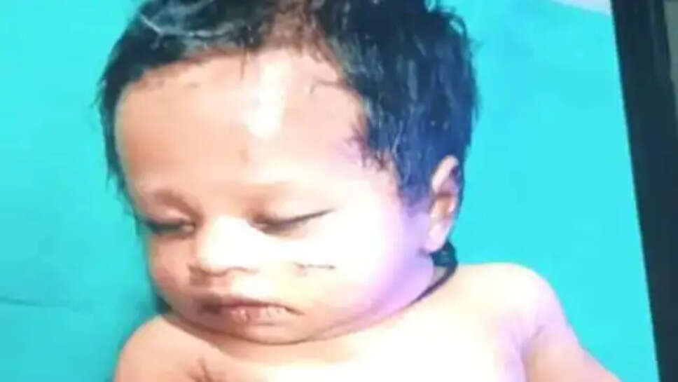 ....