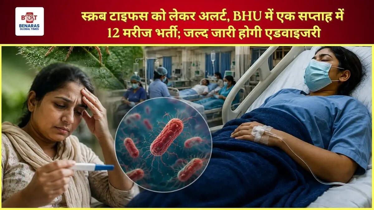 स्क्रब टाइफस को लेकर अलर्ट, BHU में एक सप्ताह में 12 मरीज भर्ती; जल्द जारी होगी एडवाइजरी