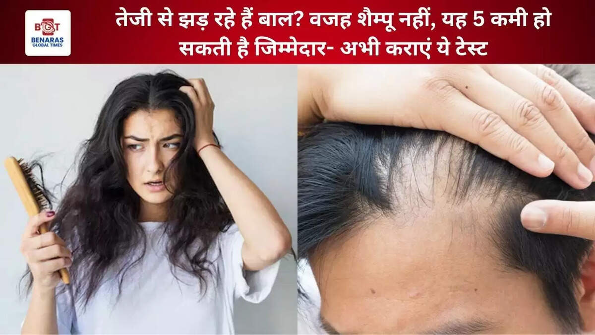  तेजी से झड़ रहे हैं बाल? वजह शैम्पू नहीं, यह 5 कमी हो सकती है जिम्मेदार- अभी कराएं ये टेस्ट