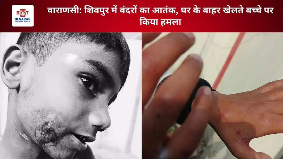 वाराणसी: शिवपुर में बंदरों का आतंक, घर के बाहर खेलते बच्चे पर हमला