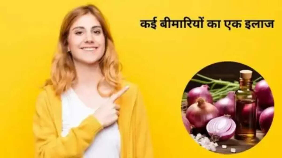 Onion
